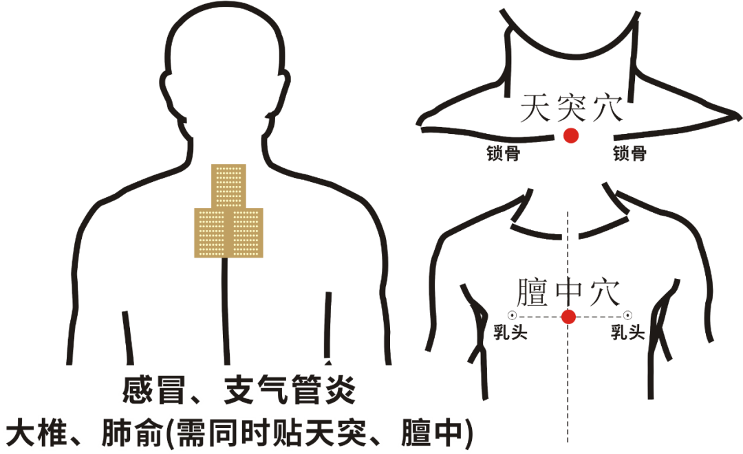 穴位2.png